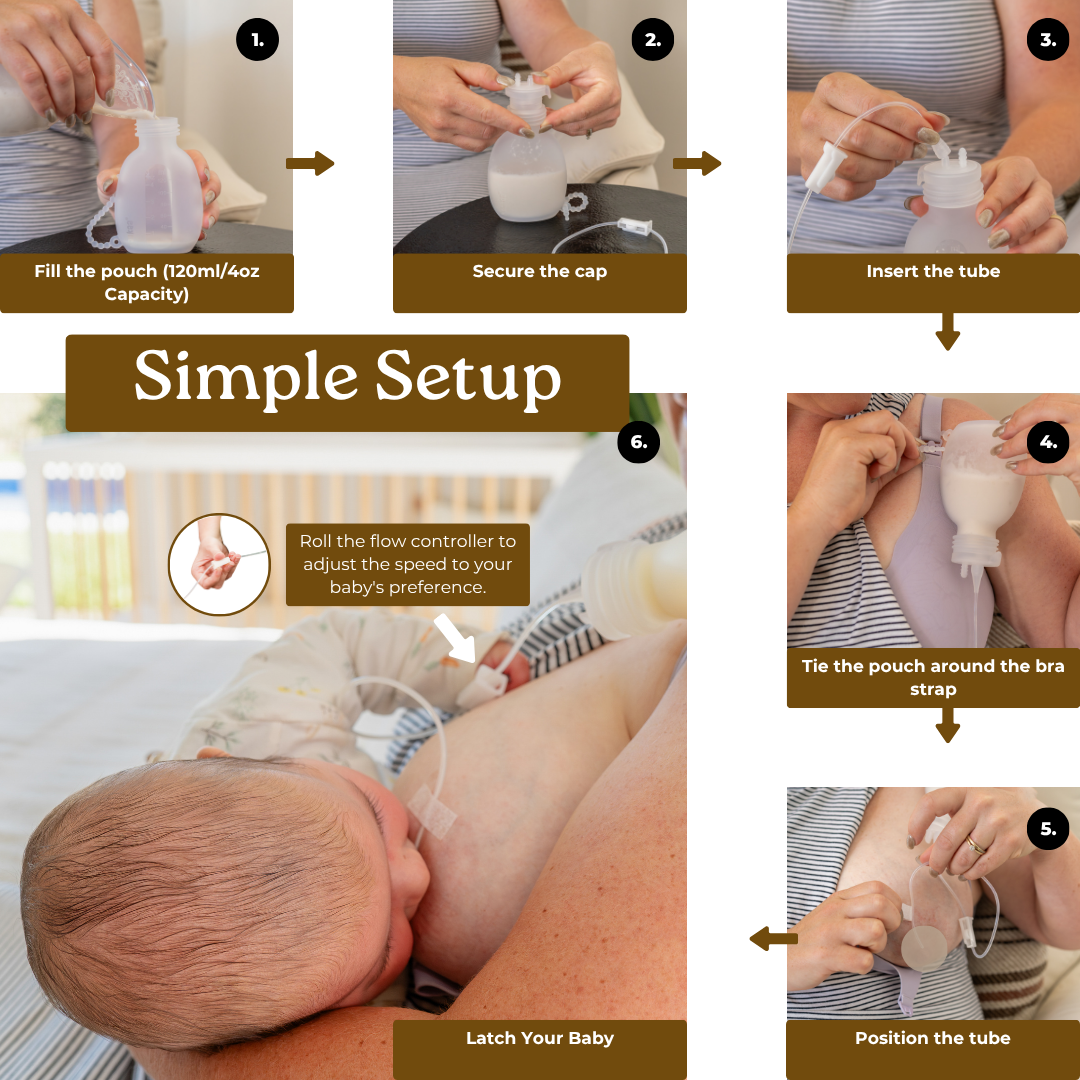 Supplemental Feeding Tube & Pouch Set