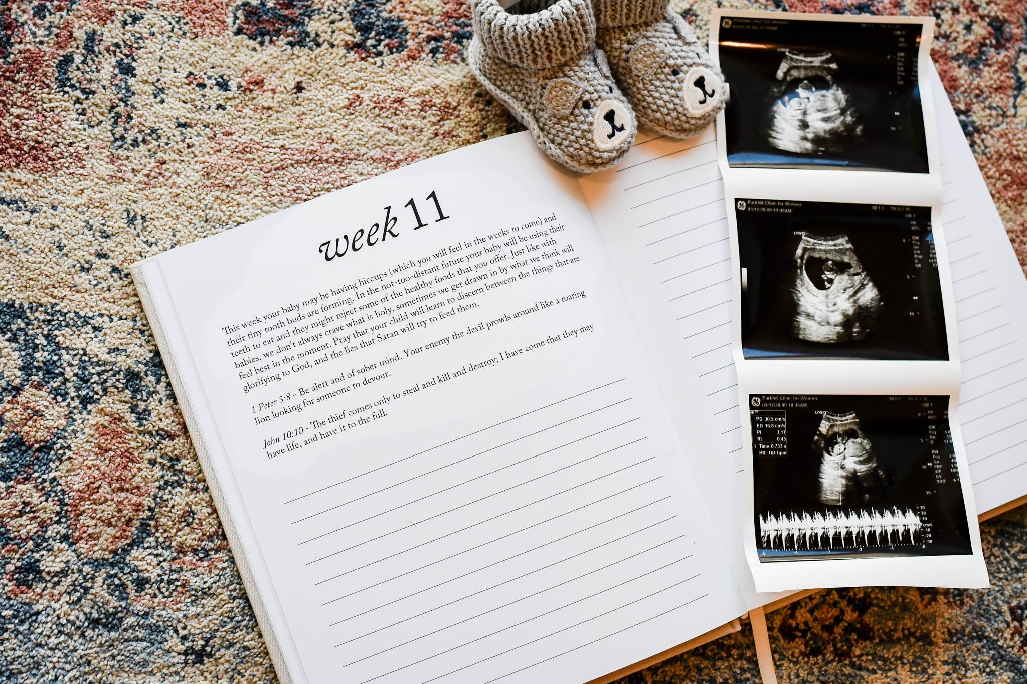 Dear Baby: Pregnancy Prayer Journal