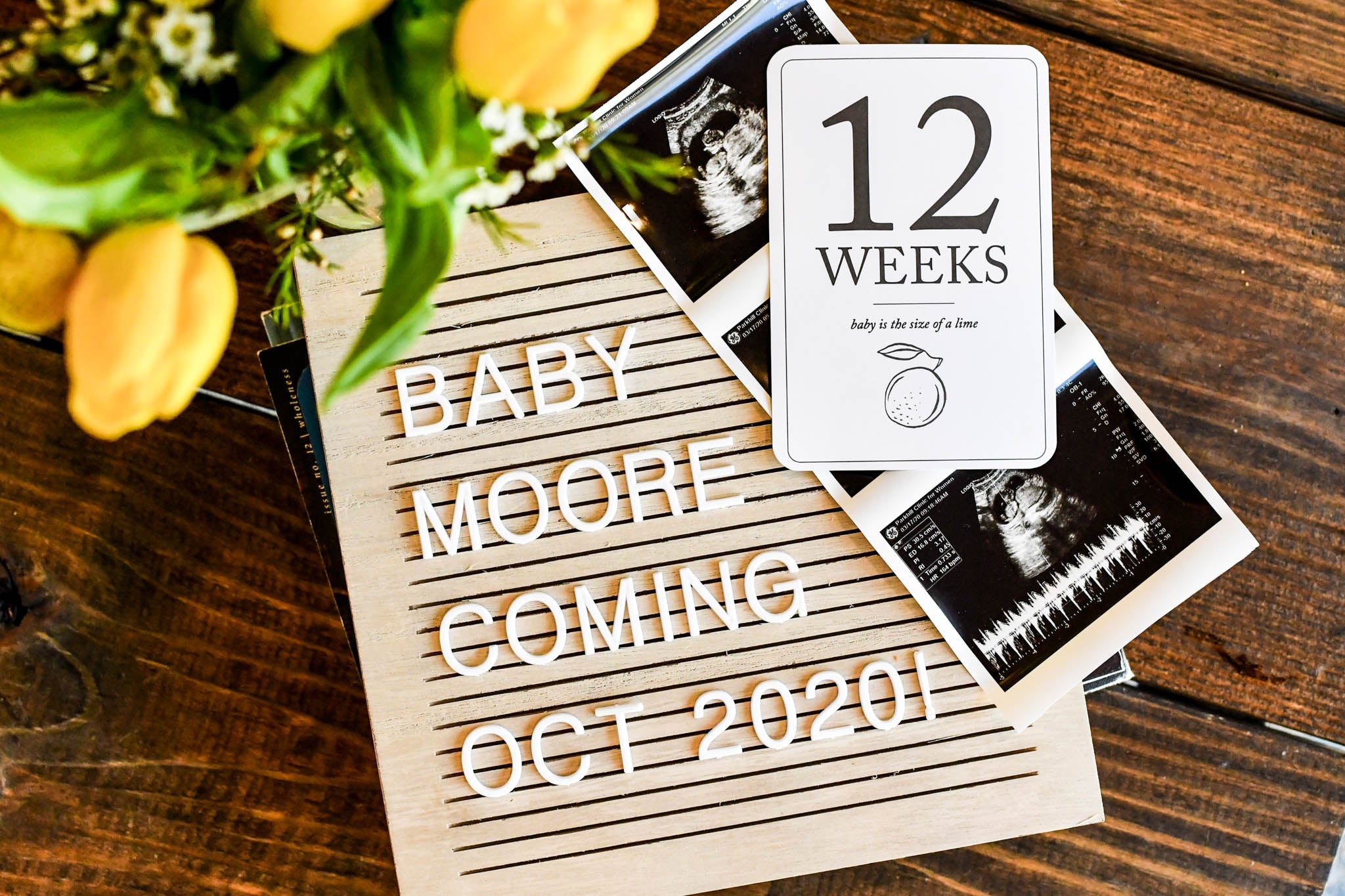 Pregnancy Announcement & Milestone Cards