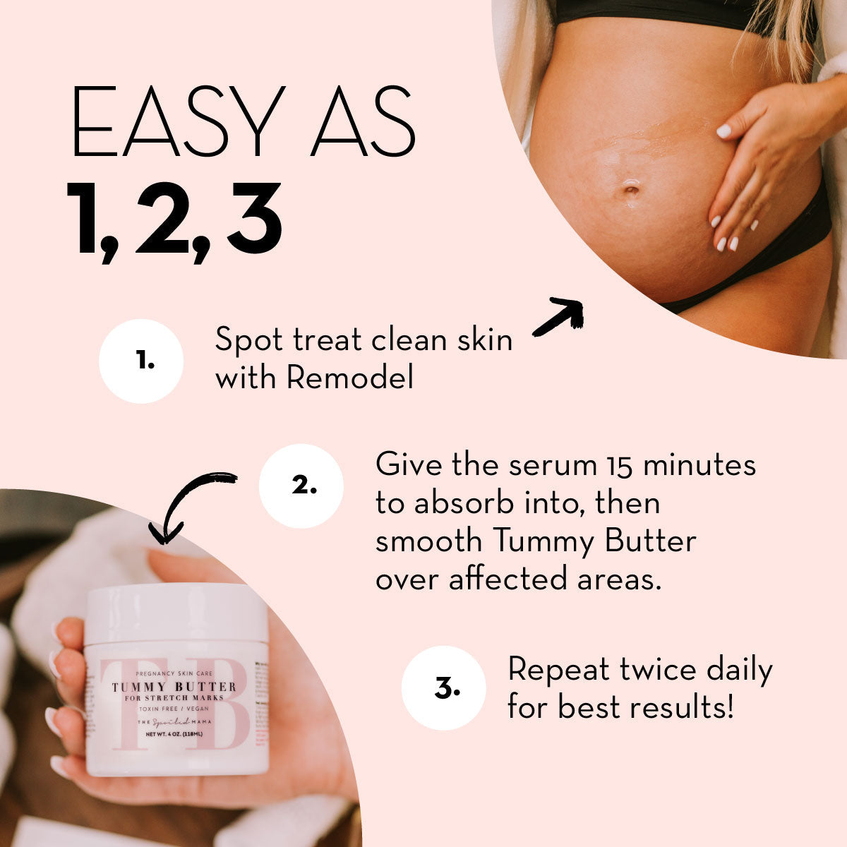 Remodel Serum: Stretch Mark Treatment