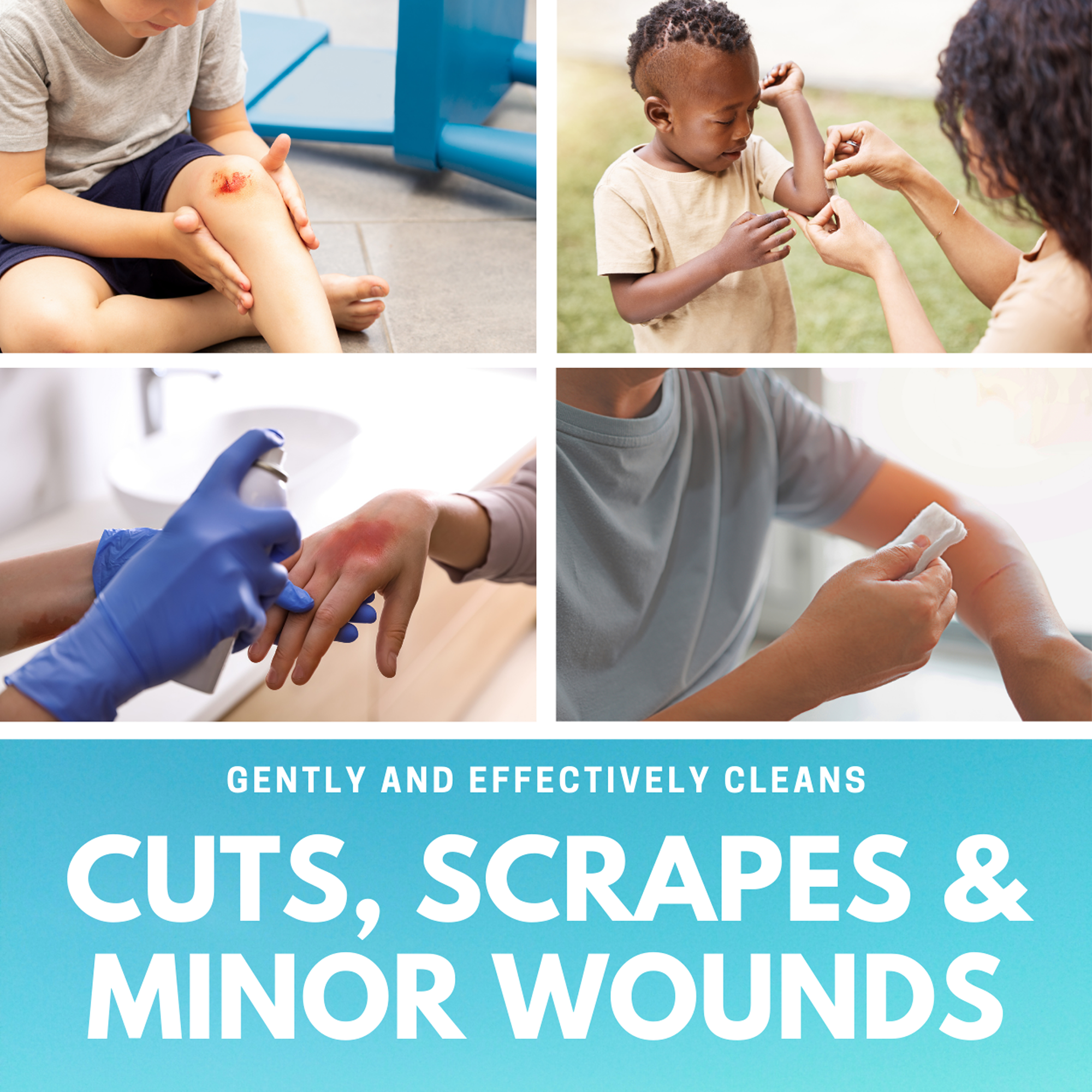 Care Wound Wash Spray