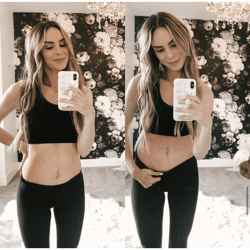 Tummy Butter Postpartum Stretch Mark Cream