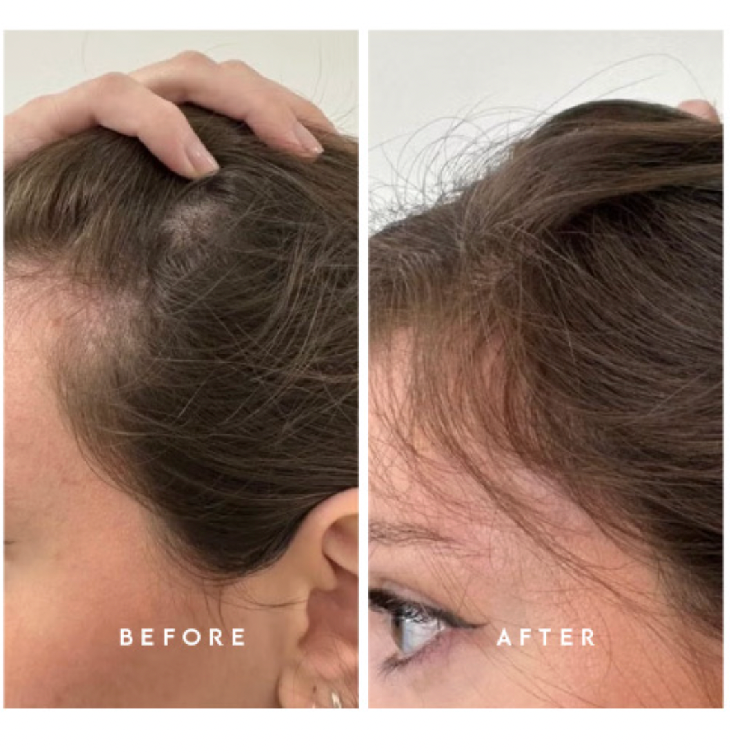 Hair She Is Hair Growth Serum