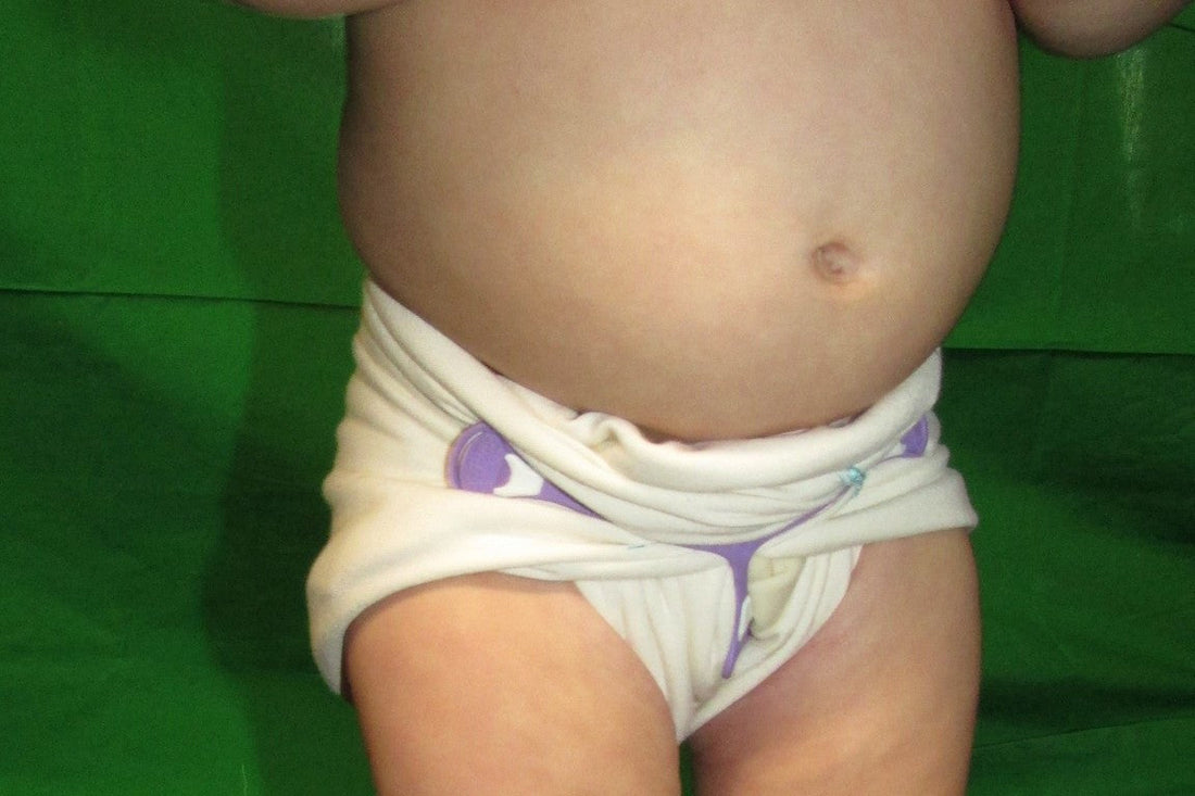 Diapering