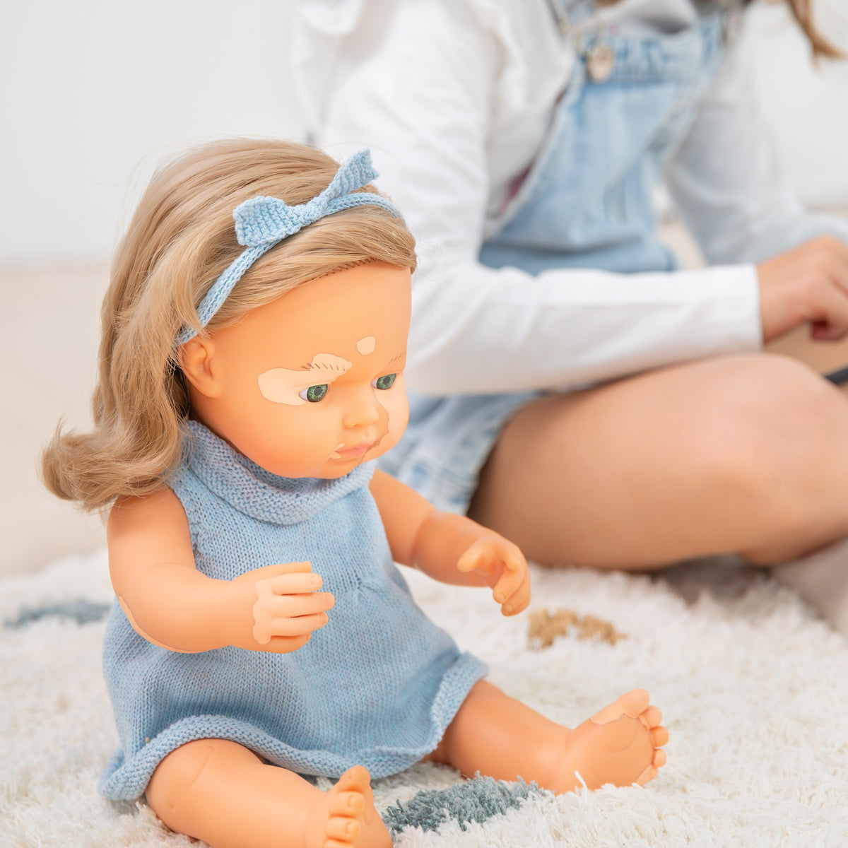 Baby Doll Caucasian Dirty Blonde Girl With Vitiligo 15''