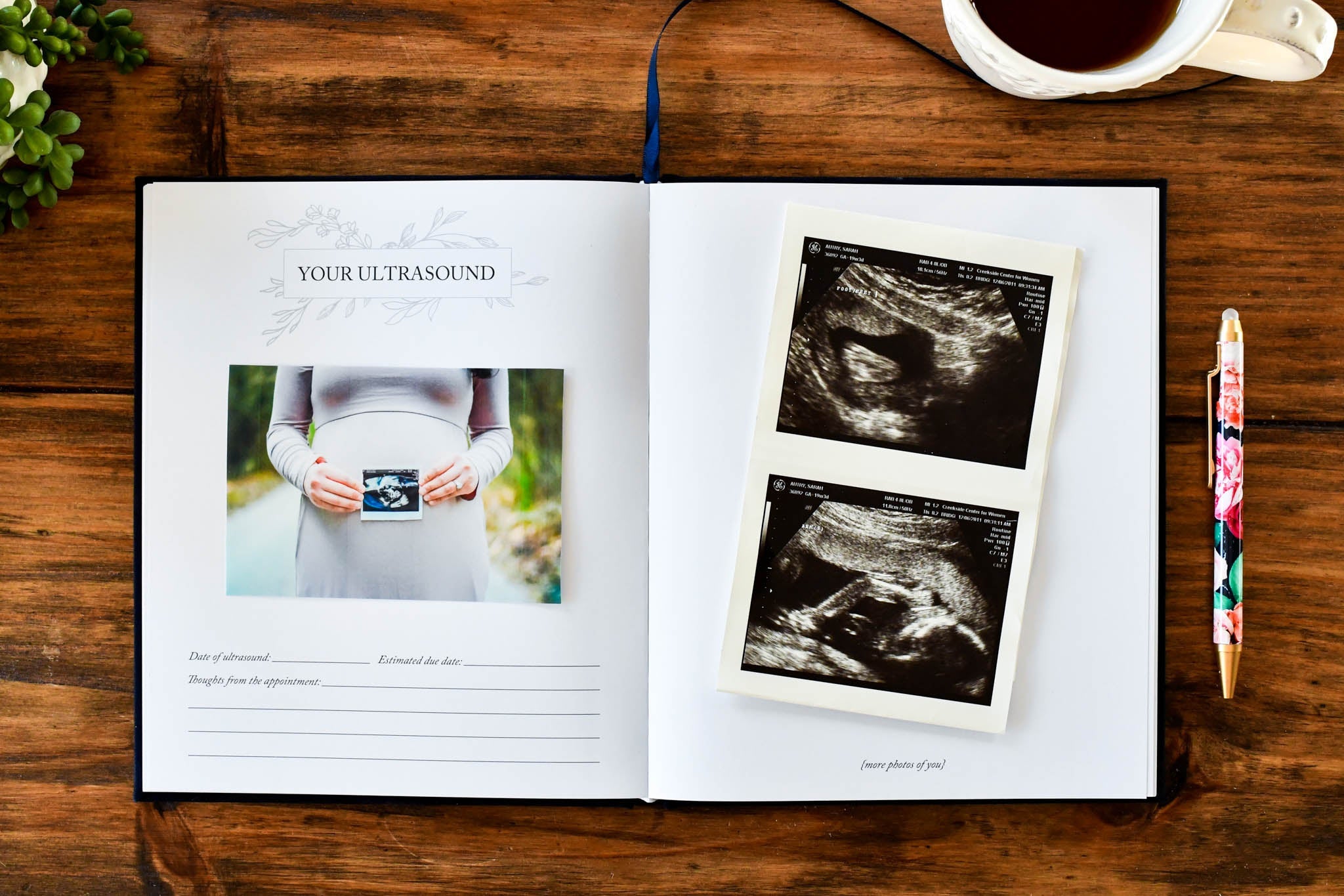 Dear Baby: Pregnancy Prayer Journal