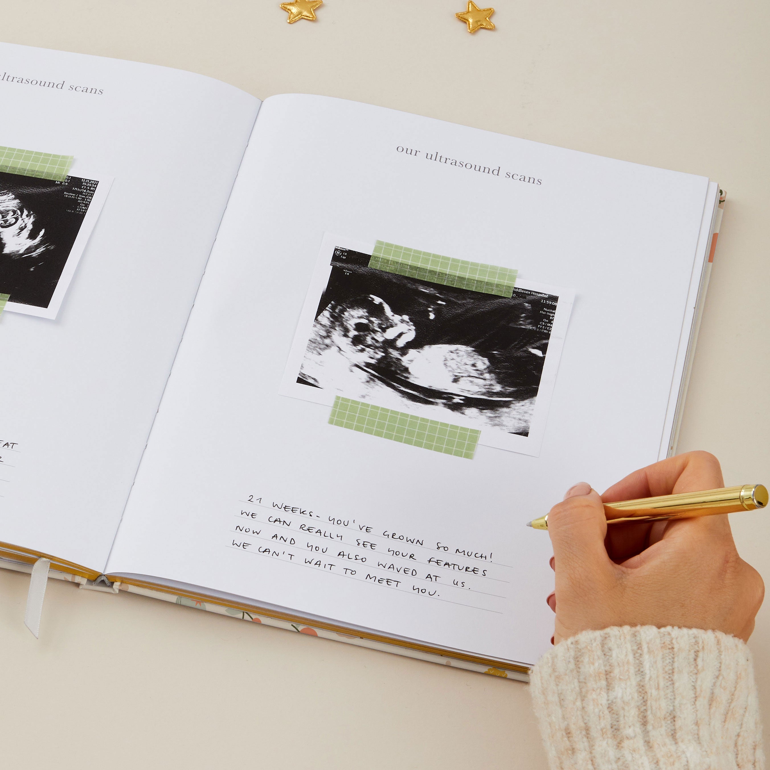 My Pregnancy Journal - Tutti Frutti