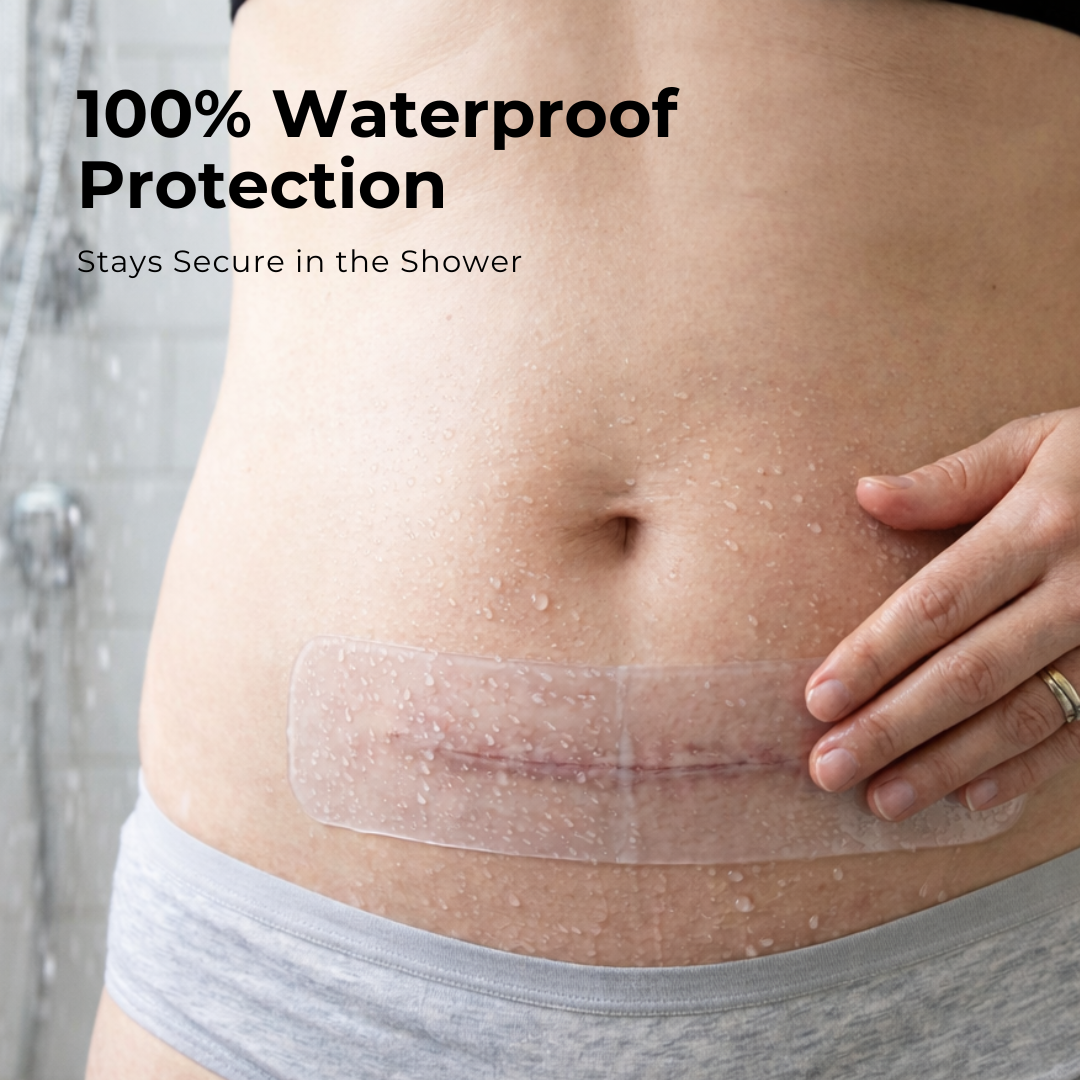 Haakaa Mom C-section Scar Silicone Patches - 6-pk (3 X 0.5mm + 3 X 1mm)
