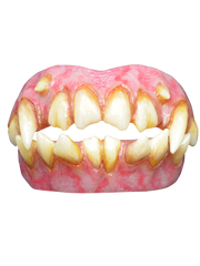Id Teeth Dentures
