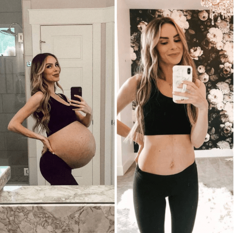 Stretch Mark Treatment Kit
