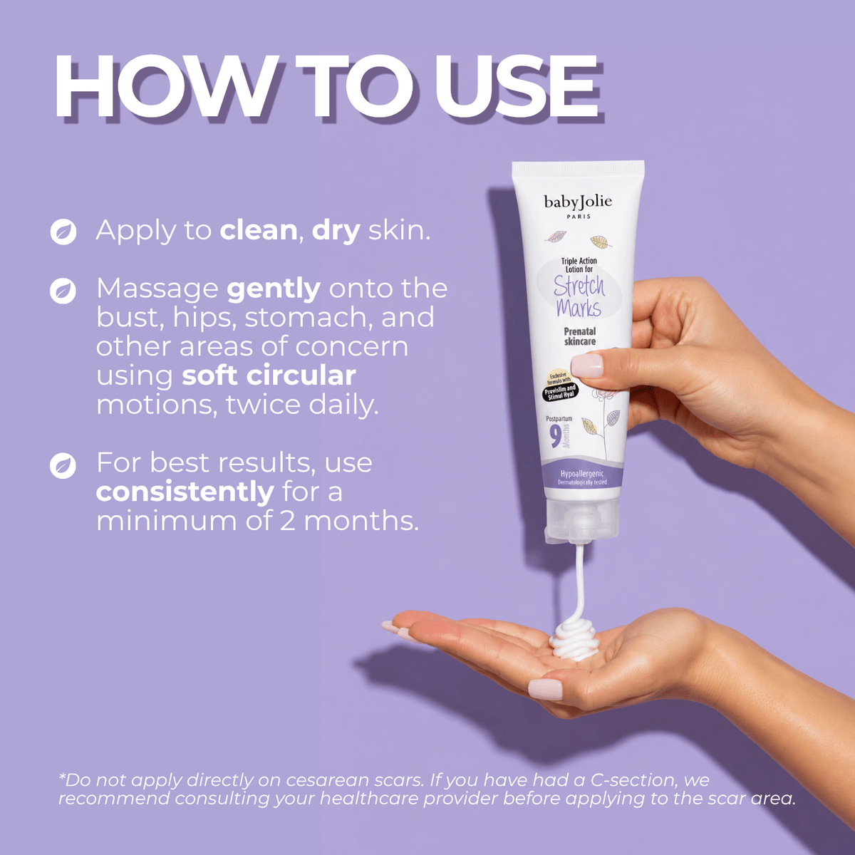 Stretch Marks Cream | Triple Action For Pregnancy