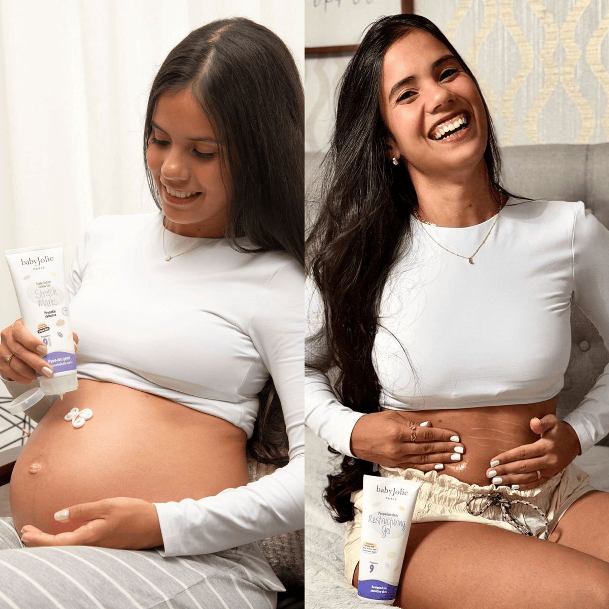 Stretch Marks Cream | Triple Action For Pregnancy